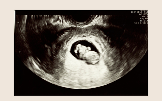 Why Taking Folic Acid Isn't Always Enough